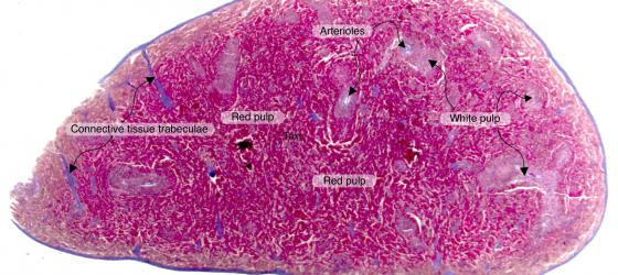 Figure C120A. Mouse spleen at low magnification