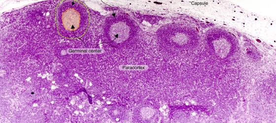 Figure C126A. Human lymph node