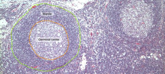 Figure C129. Human lymph node at higher magnification