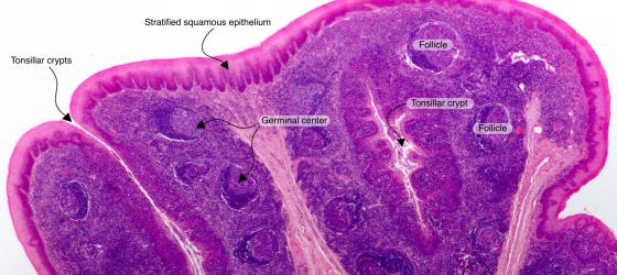 Figure C131A. Human palatine tonsil