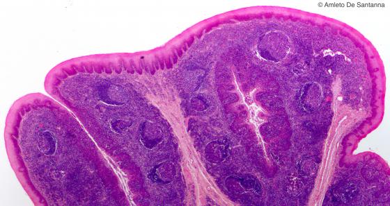Figura C131B. Tonsilla palatina umana. Micrografia a piccolo ingrandimento di tonsilla palatina in cui si nota, sotto un epitelio pavimento stratificato, il tessuto linfoide organizzato in follicoli. La presenza di epitelio pavimento stratificato ci permettere di distinguerla dalla tonsilla faringea. Em-Eo 12,5