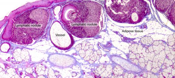 Figure C132. Human lingual tonsil