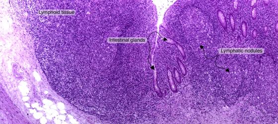 Figure C138A. Human vermiform appendix