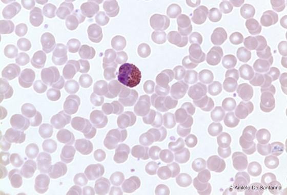 Figura C152. Striscio di sangue umano