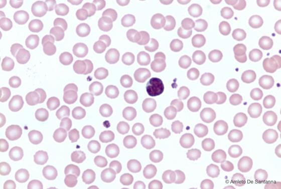 Figura C153. Striscio di sangue umano