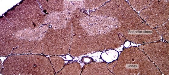 Figure C16. Mouse thymus