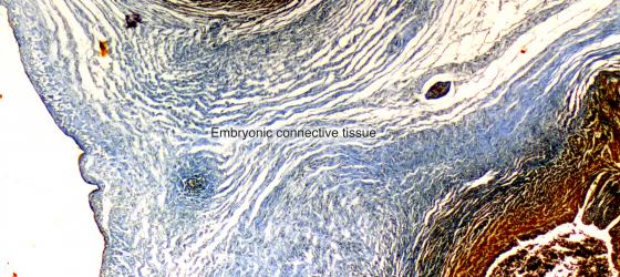 Figure C2. Human umbilical cord