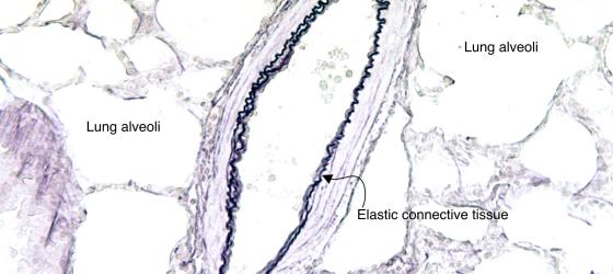 Figure C23. Rabbit lung