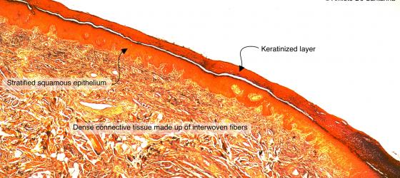 Figure C30. Human skin