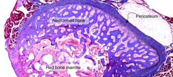 Figure C39. Human fetal rib