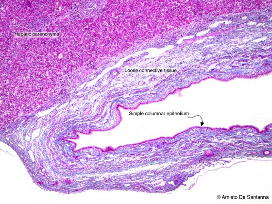 Figure C4. Human gallbladder