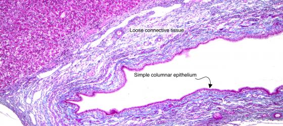 Figure C4. Human gallbladder