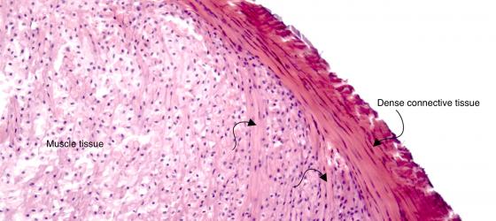 Figure C41. Human myotendinous junctio