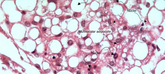 Figure C48. Adipose tissue of a marmot