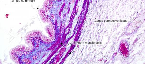 Figure C5. Human gallbladder