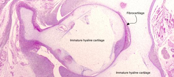 Figure C53. Human fetal coxofemoral joint