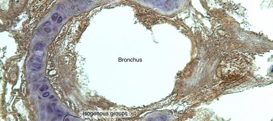 Figure C58. Dolphin lung