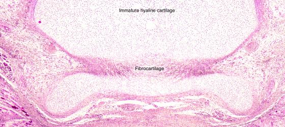 Figure C62. Human fetal vertebra