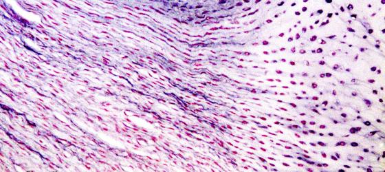 Figure C64. Human intervertebral disc