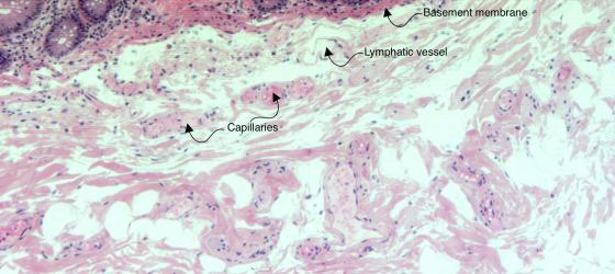 Figure C7. Human large intestine