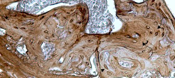 Figura C79. Femore di topo a più forte ingrandimento