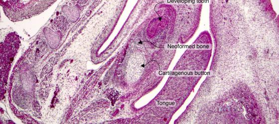 Figure C86. Mouse fetus