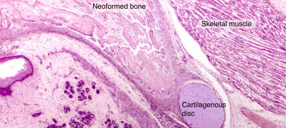 Figure C89. Human fetal mandible