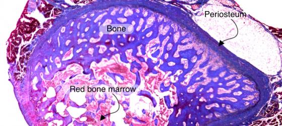 Figure C93. Human fetal rib