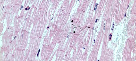 Figura M19. Tessuto muscolare striato cardiaco umano