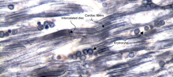 Figure M20. Human cardiac muscle tissue