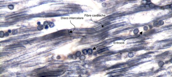 Figura M20. Tessuto muscolare striato cardiaco umano a forte ingrandimento