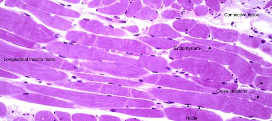 Figure M5. Human tongue