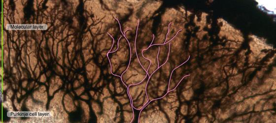 Figure N17. Mouse cerebellum