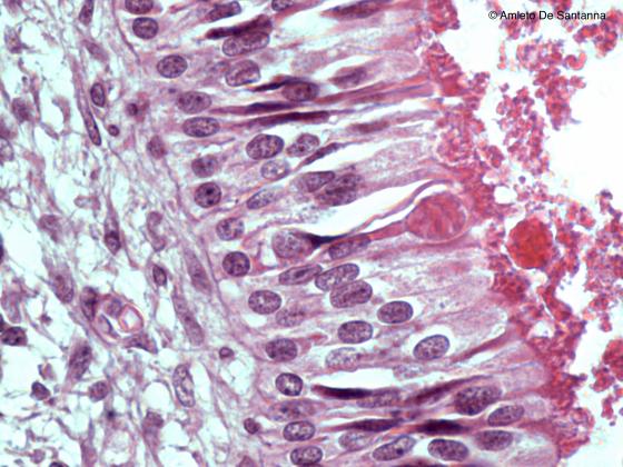 Figura N20B. Mucosa olfattiva di feto umano