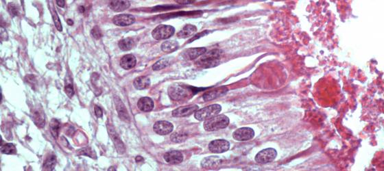 Figura N20B. Mucosa olfattiva di feto umano