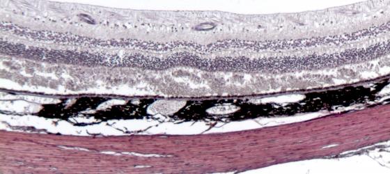 Figura N21B. Bulbo oculare di uomo