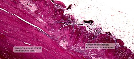 Figure N40. Human gut