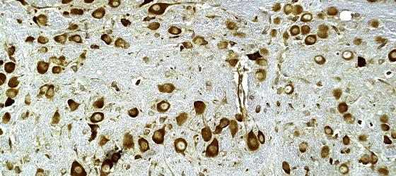 Figura N6. Corteccia telencefalica di topo