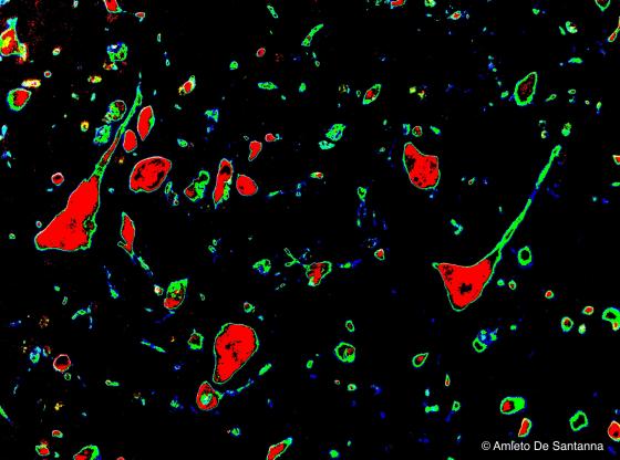 Figura N7. Corteccia telencefalica di topo. Micrografia elaborata digitalmente. Neuroni piramidali a forte ingrandimento. La parte centrale del corpo cellulare è colorata in rosso mentre i dendriti, le fibre e le cellule della glia in verde. 200x