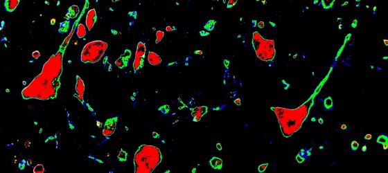 Figura N7. Corteccia telencefalica di topo. Micrografia elaborata digitalmente. Neuroni piramidali a forte ingrandimento. La parte centrale del corpo cellulare è colorata in rosso mentre i dendriti, le fibre e le cellule della glia in verde. 200x