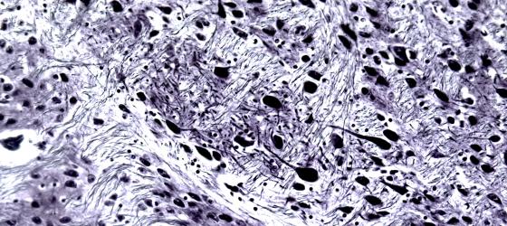 Figuta N9. Corteccia telencefalica umana