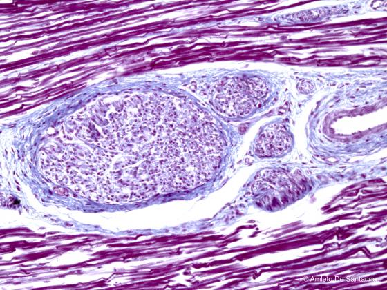 Figura C11. Tessuto muscolare umano