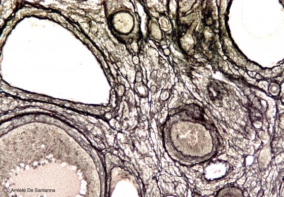 Figura C14. Ovario di topo a più forte ingrandimento