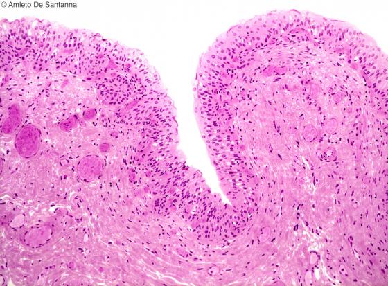 Figura C33. Vescica urinaria umana