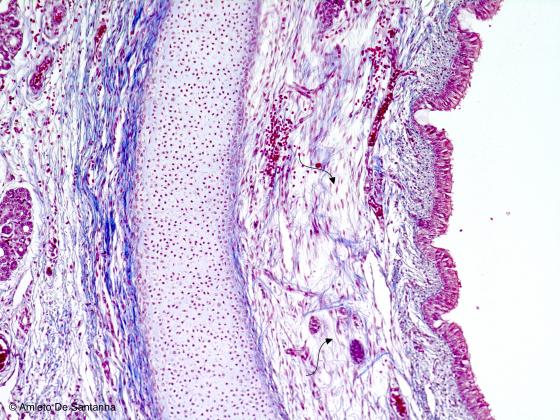 Figura C6. Trachea fetale umana