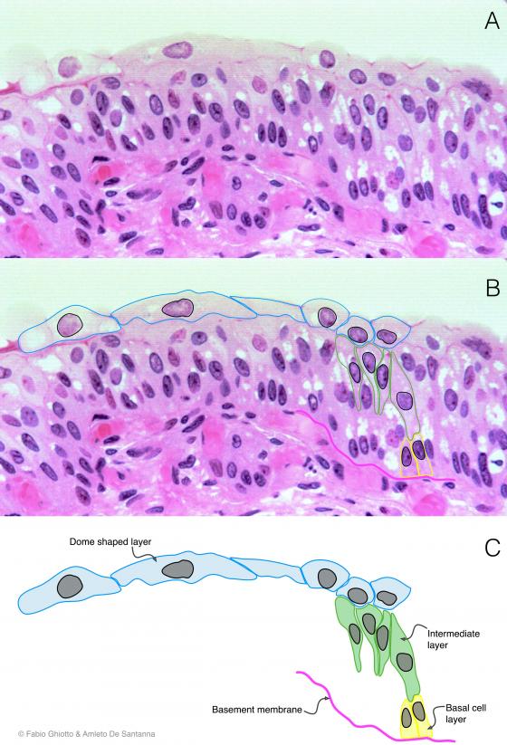 Figure E100. Digitally annotated micrograph of transitional epithelium