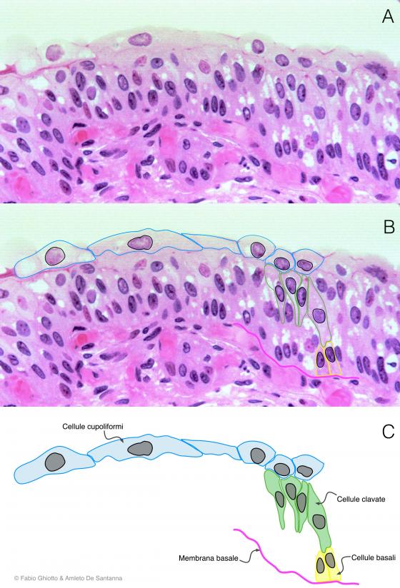 Figura E100. Micrografia di epitelio polimorfo o di transizione annotata digitalmente