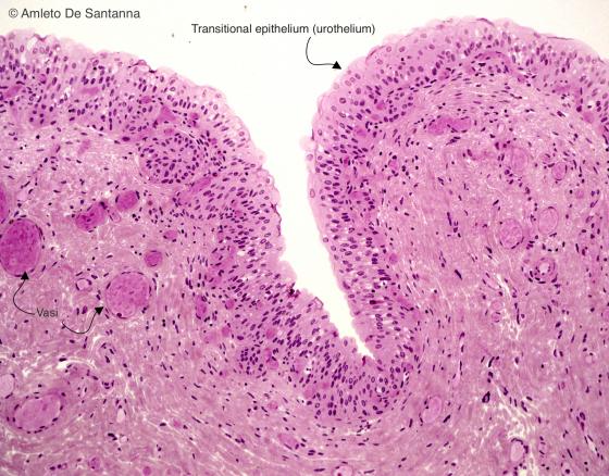 Figure E101. Human urinary bladder