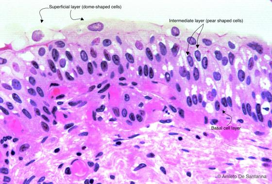 Figure E102. Human urinary bladder