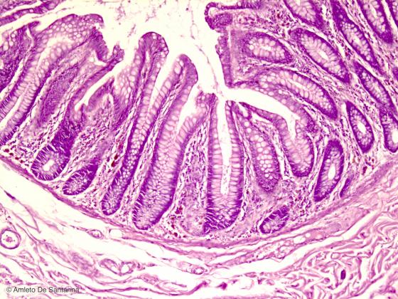 Figura E107. Intestino tenue umano